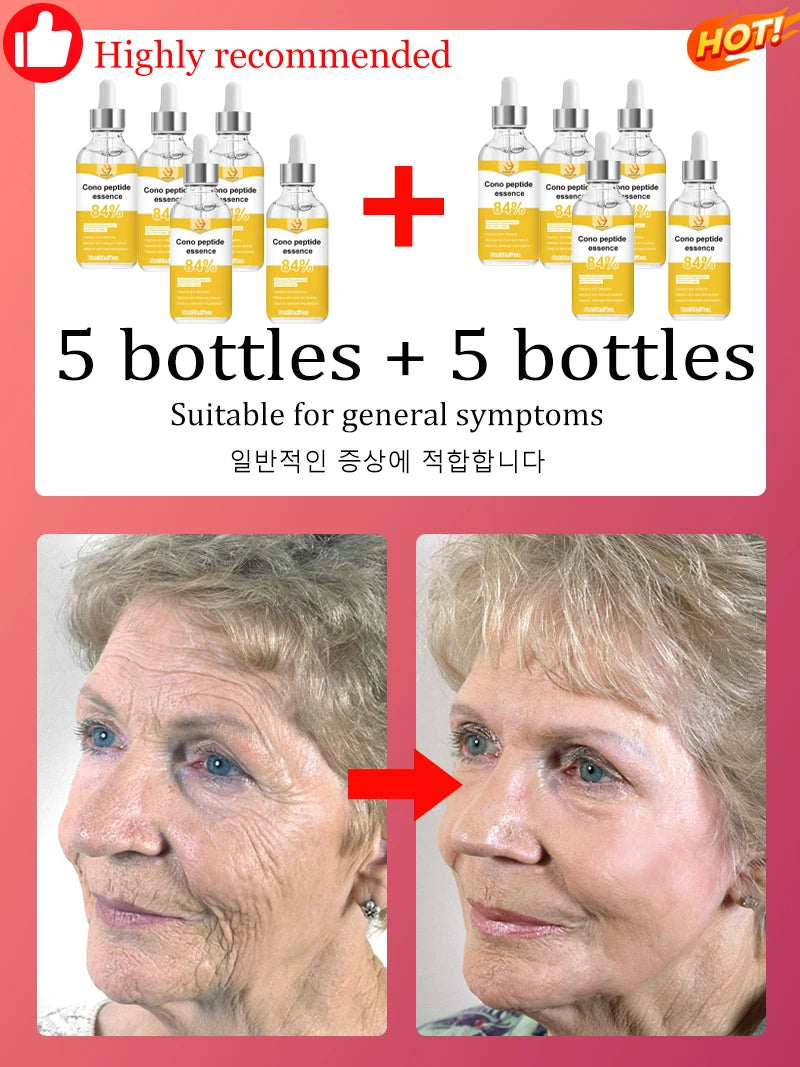 for wrinkles, 20 years younger