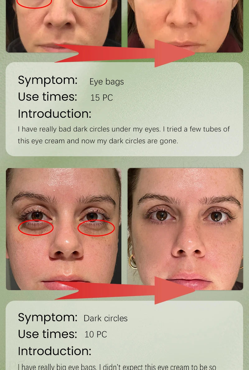 M&T Wear – 3 Days to Look 20 Years Younger Eye Cream | Anti-Aging, Dark Circle & Puffiness Repair Formula