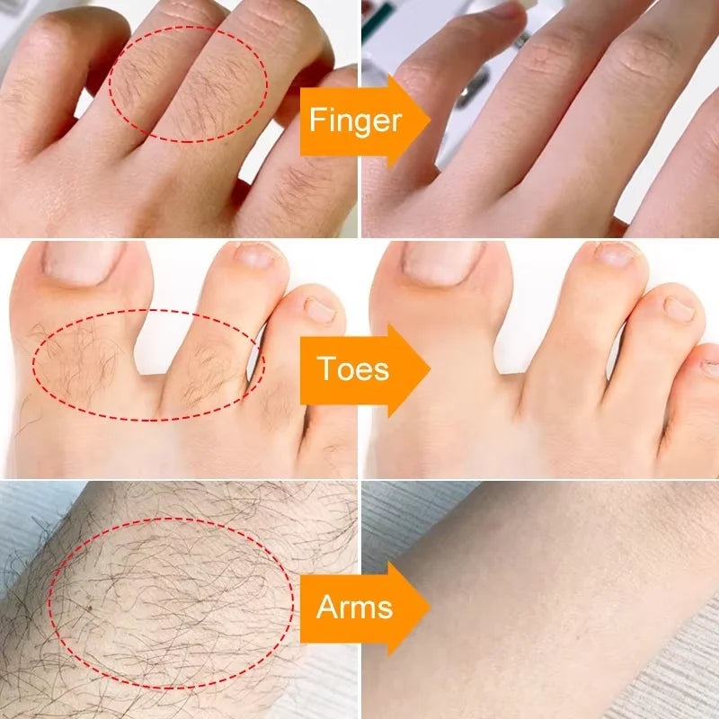 M&T Wear – 3 Minutes Fast Hair Removal Cream (20g)