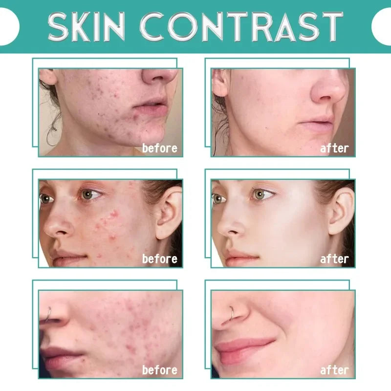 Concentrated Serum Anti Aging Pure Retinol Vitamin B3 Vitamin C Niacinamide Serum Facial serums Blue Copper Peptide Base 30ml