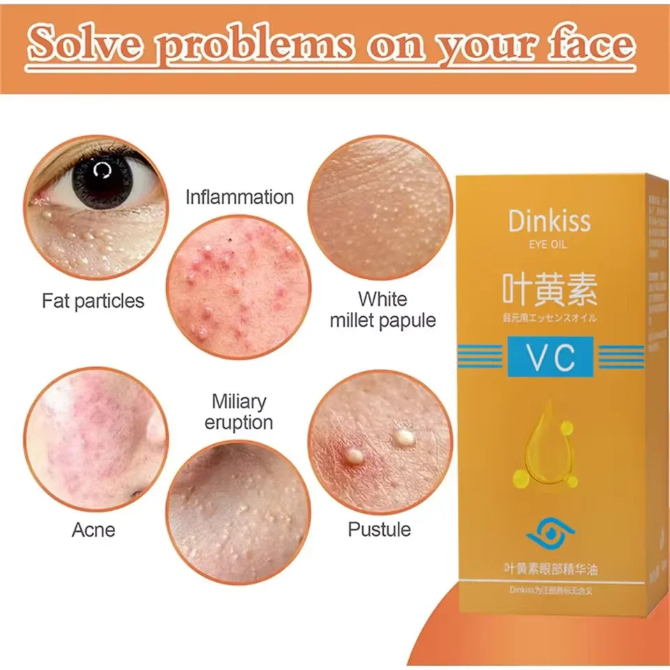 M&T Wear - Eye Fat Particle Removal & Milia Repair Serum