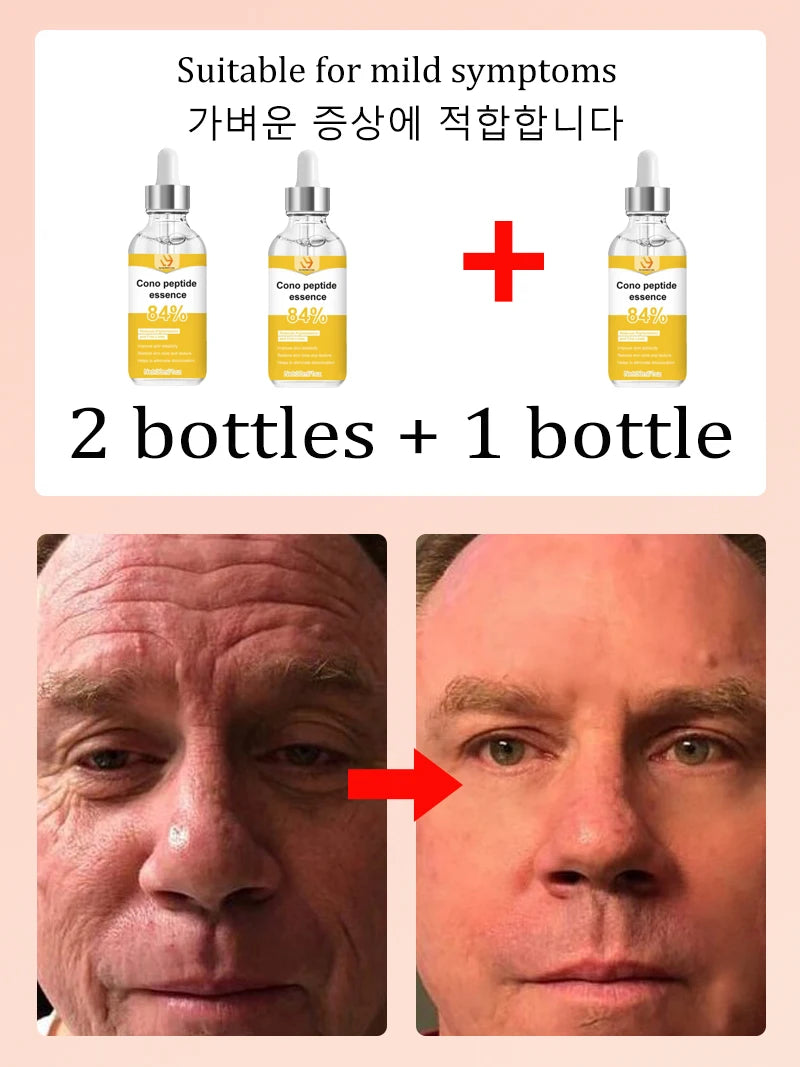 for wrinkles, 20 years younger