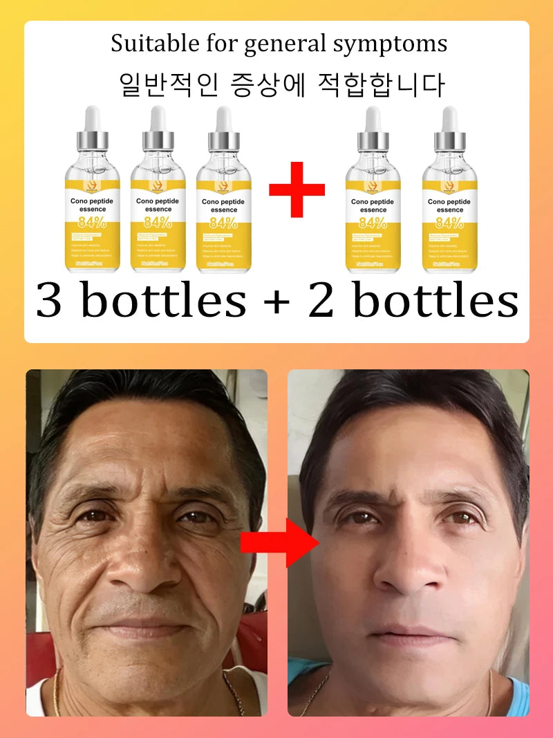 for wrinkles, 20 years younger