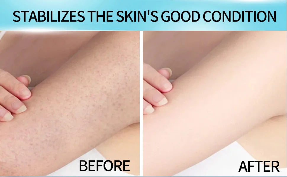 M&T Wear – Urea Cream 60% Whole Body Moisturizing Lotion