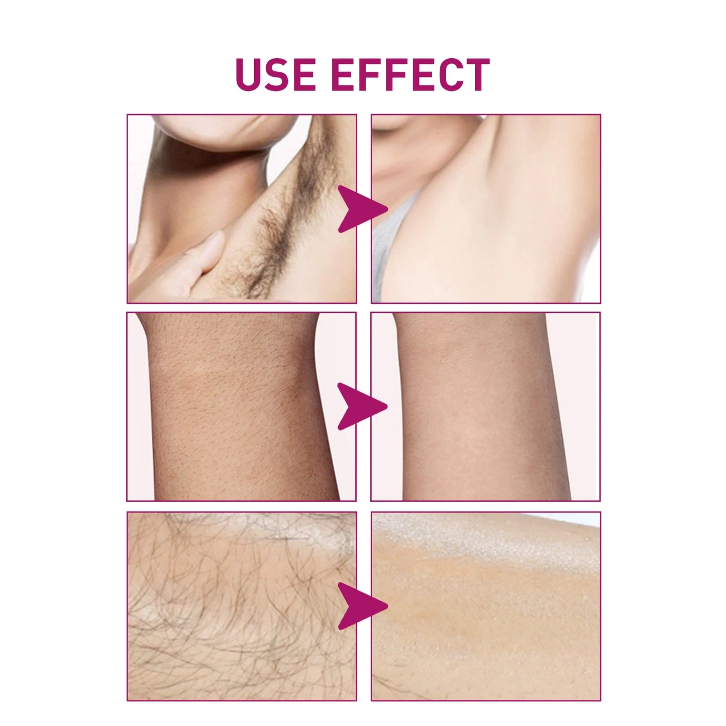 M&T Wear – OceAura Permanent Hair Removal Cream for Men