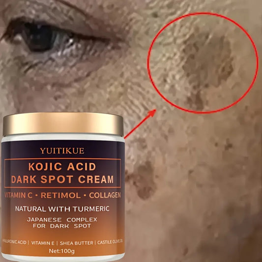 Arbutin fading cream, Vitamin C, retinol, collagen, natural curcumin, hyaluronic acid, Vitamin E, shea butter, castor olive oil.