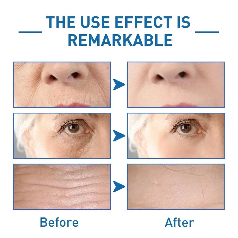 Concentrated Serum Anti Aging Pure Retinol Vitamin B3 Vitamin C Niacinamide Serum Facial serums Blue Copper Peptide Base 30ml