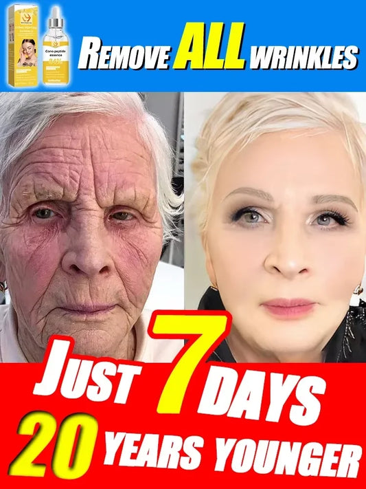 for wrinkles, 20 years younger