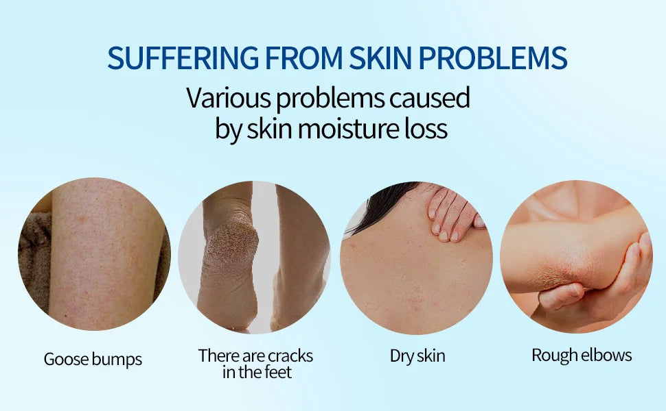 M&T Wear – Urea Cream 60% Whole Body Moisturizing Lotion