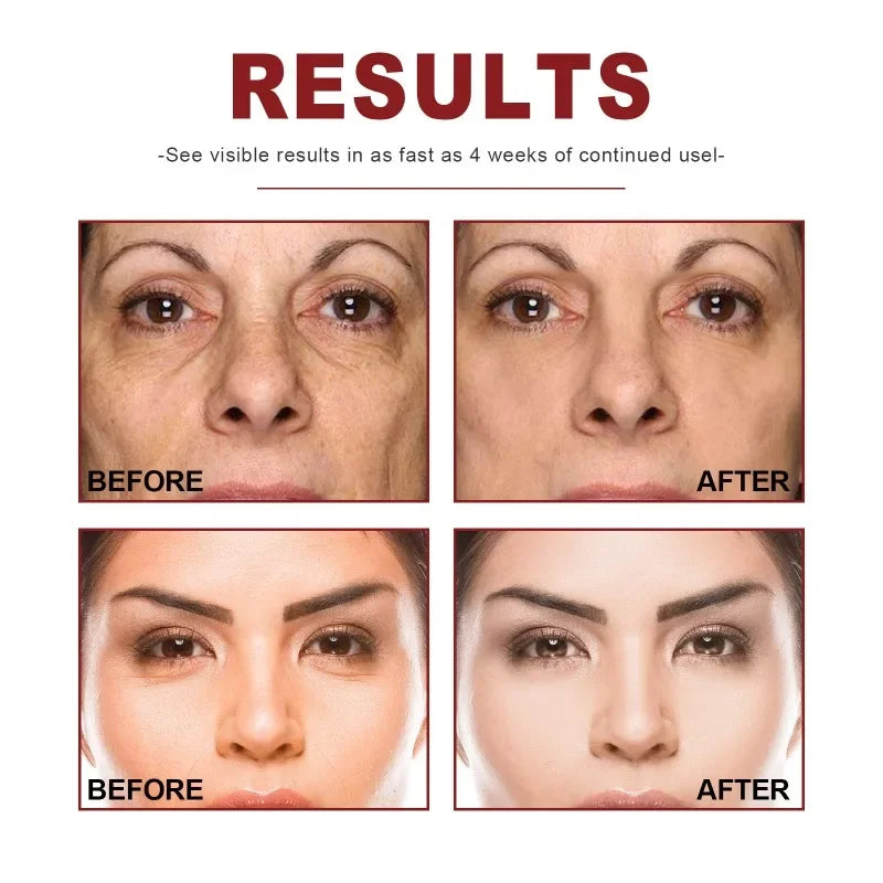 Concentrated Serum Anti Aging Pure Retinol Vitamin B3 Vitamin C Niacinamide Serum Facial serums Blue Copper Peptide Base 30ml