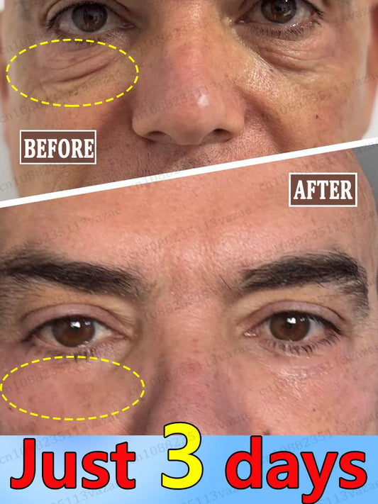 3 days to make you 20 years younger