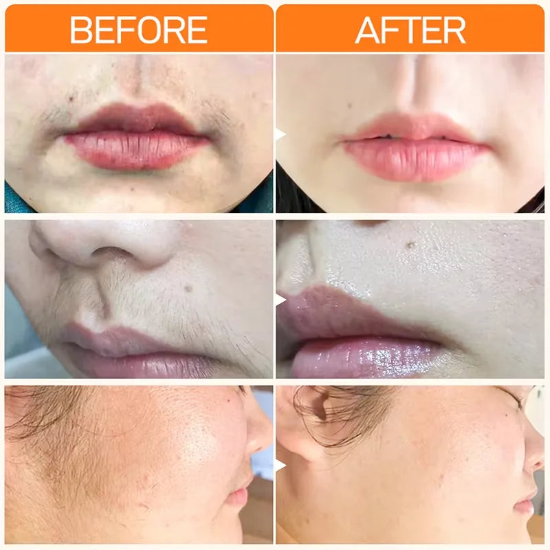 M&T Wear – 3 Minutes Fast Hair Removal Cream (20g)