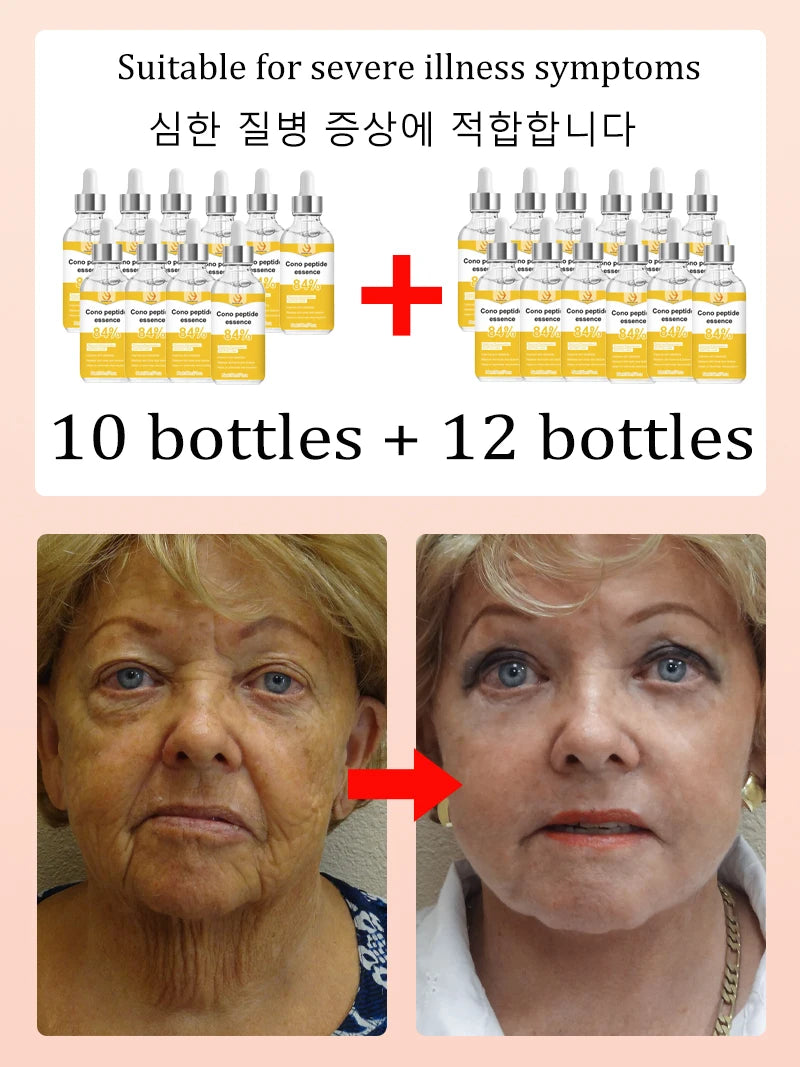 for wrinkles, 20 years younger