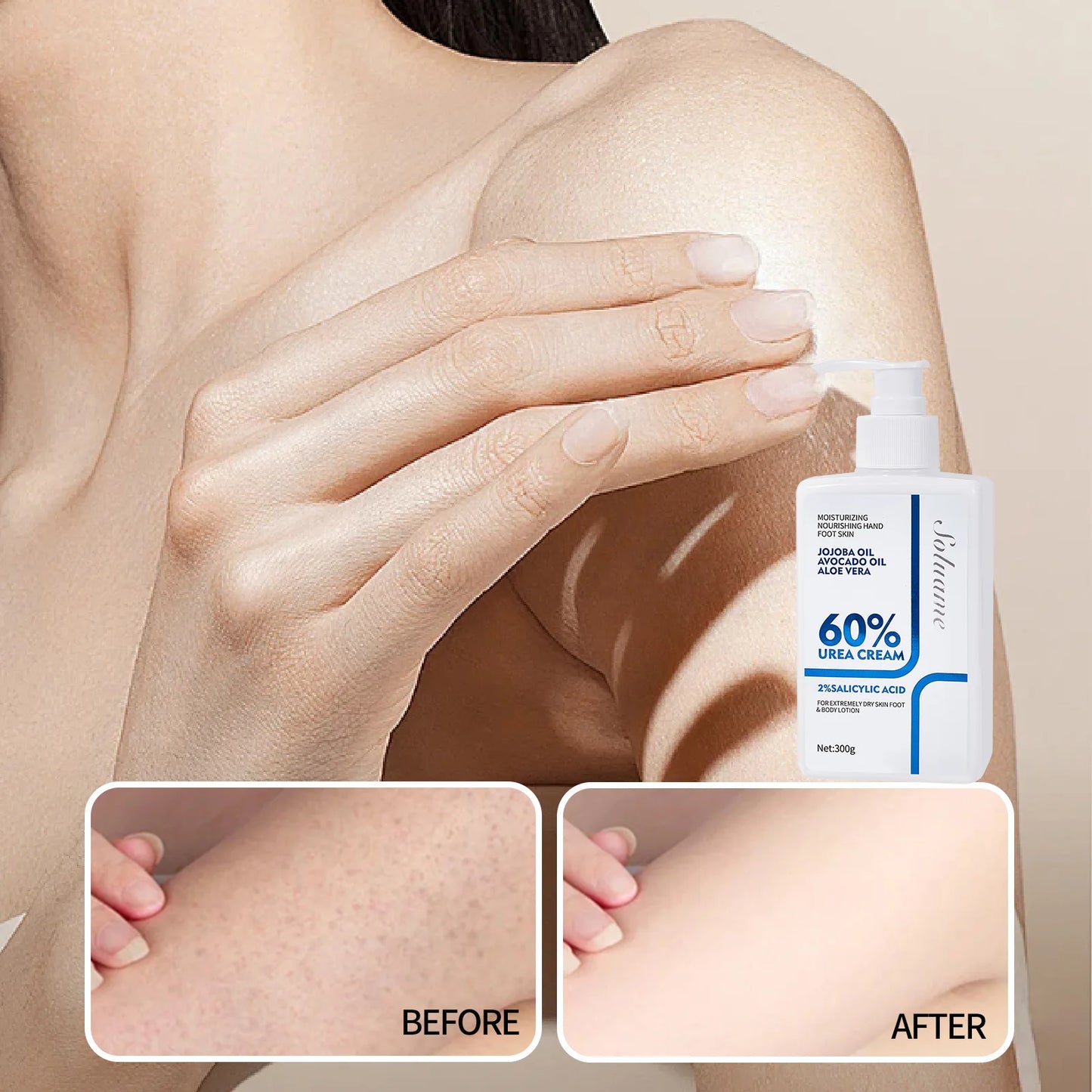 M&T Wear – Urea Cream 60% Whole Body Moisturizing Lotion