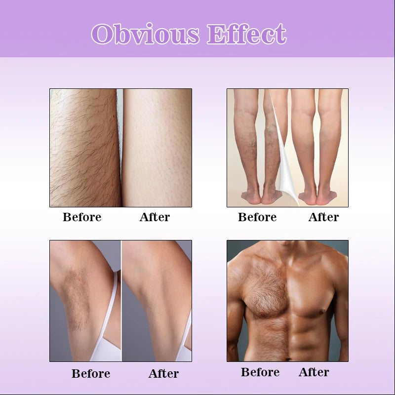 M&T Wear - Permanent Hair Removal Spray (20ml) | Painless & Nourishing Lavender Formula for Silky Smooth Skin