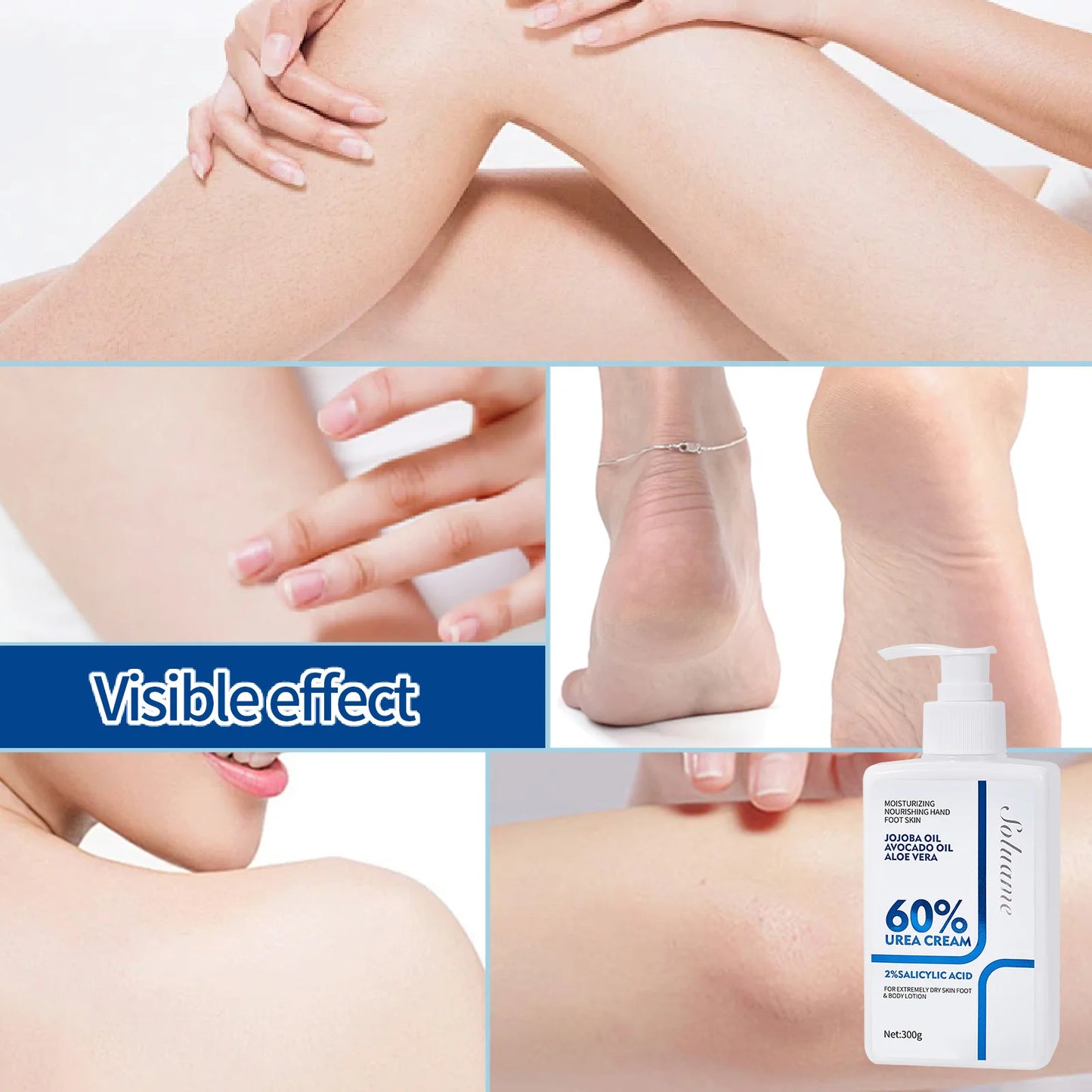 M&T Wear – Urea Cream 60% Whole Body Moisturizing Lotion