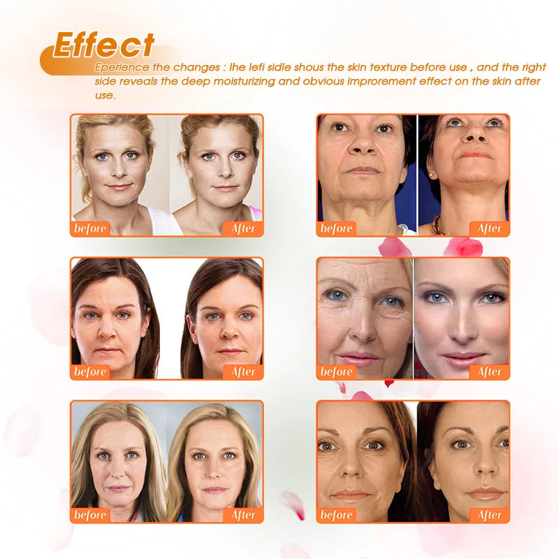 Astaxanthin Face Cream Anti Aging Moisturizing Quick Absorption Moisturizing Antioxidant Facial Cream Reduce Wrinkles Skin Care