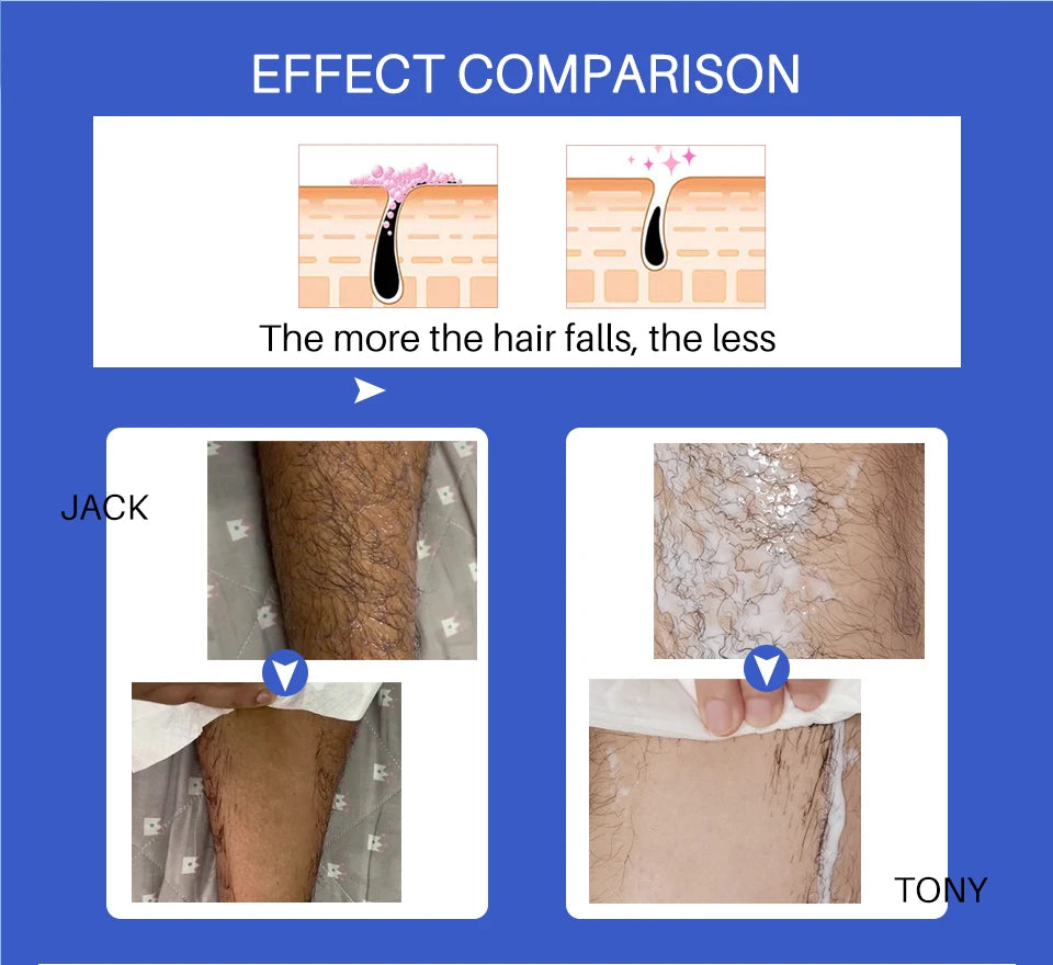 M&T Wear - 8-Min Painless Hair Removal Spray for Women | Cucumber Fresh Formula for Bikini, Armpit & Body